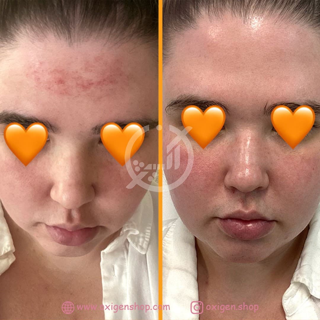 کپسول تقویت پوست هیرتامین SKINtamin کپسول تقویت پوست هیرتامین SKINtamin